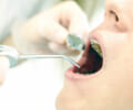 長岡市でも人気の予防歯科！歯のクリーニングを受ければきれいになる！